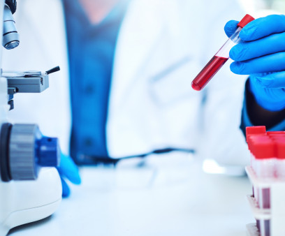 Closeup shot of a scientist analyzing samples in a laboratory