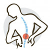 illustration of back pain