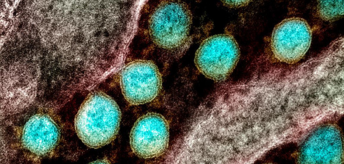 Food Allergy Associated with Lower Risk of SARS-CoV-2 Infection - Vimarsana News