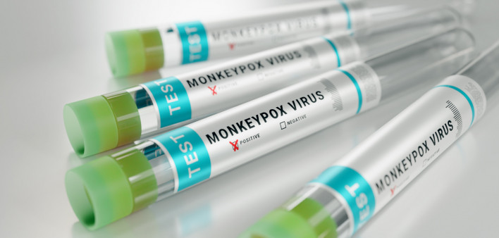monkeypox virus