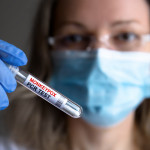 monkypox pcr test in test tube