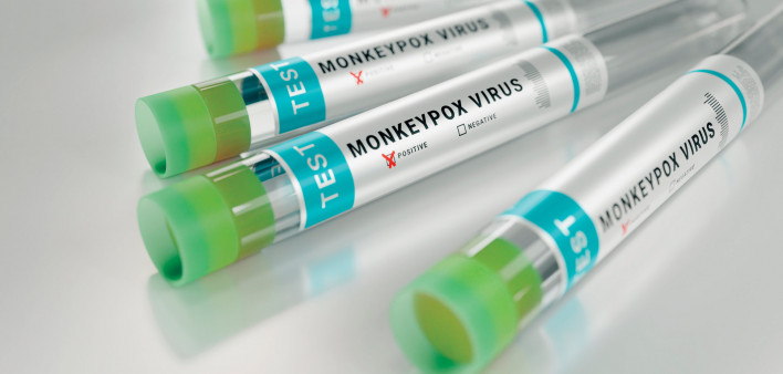 tubes monkeypox virus