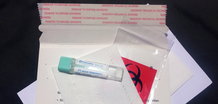 Home Test Program Doubles Colon Cancer Screening and Cuts Deaths