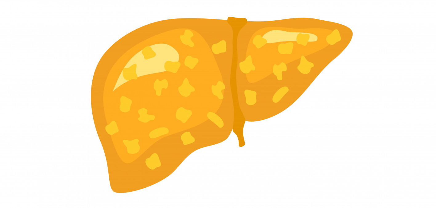 Flagging Liver Disease Risk