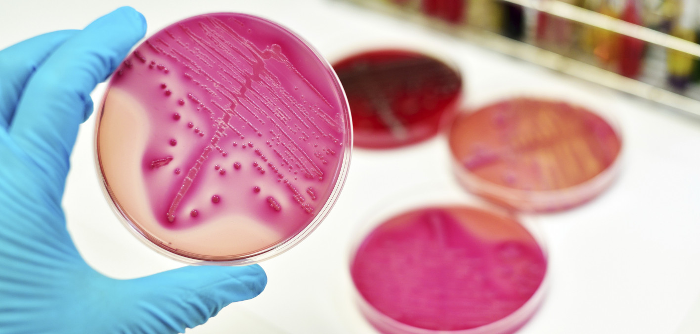 Mycobacterium avium